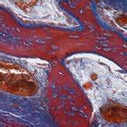 Image result for Bone Tissue Formation