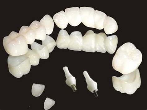 种植牙齿多少钱_牙齿种植哪里好_种植牙维持几年_五洲深圳种植牙医院