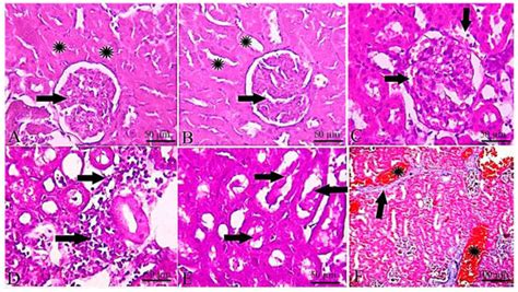Investigation of the In-Vivo Cytotoxicity and the In Silico-Prediction ...