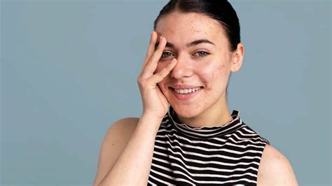 Facial Oils For Dry Skin | Facial Oils For Oily Skin | Facial Oils For ...