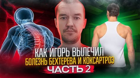 Как Игорь вылечил болезнь Бехтерева и коксартроз. Часть II - YouTube