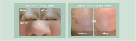 KAINE Rosemary Relief Gel Cleanser 150 ml : Amazon.in: Beauty