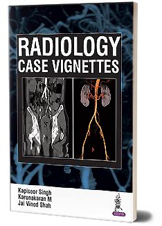 JaypeeDigital | Neuroimaging