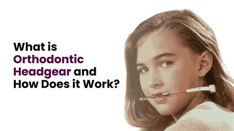 What is Orthodontic Headgear and How Does it Work?