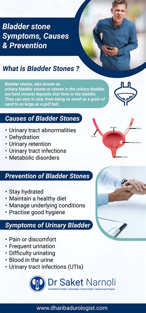 Bladder Stones Giant Uric Acid Stone In The Bladder | Cleveland Clinic