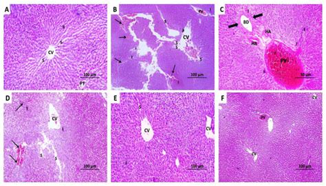 Repositioning Perindopril for Mitigation of Methotrexate-Induced ...