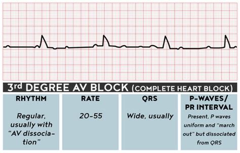 Image result for ACLS Code Blue Algorithm