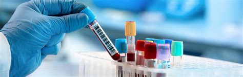 Medical & Chemical Laboratory Water Filtration & Purification System ...