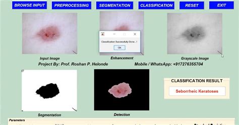 Image result for Skin Disease Detection Using MATLAB
