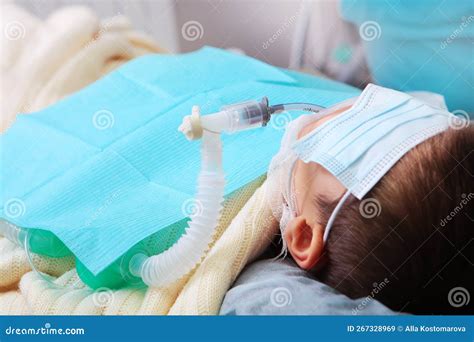 Little Boy is Under General Anesthesia. a Breathing Tube in the Baby ...