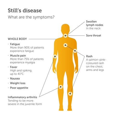Still’s disease – AOSD, SJIA | Sobi