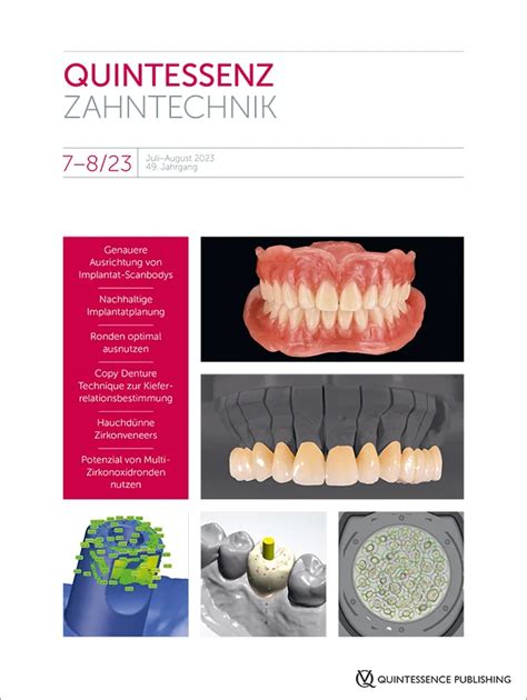 QZ - Quintessenz Zahntechnik, 07-08/2023 | Quintessenz Verlags-GmbH