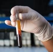 Low Prices Animal Cell Culture And Telated Products From Serana | Life ...