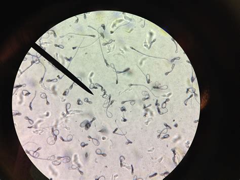 How To Look At Sperm Through A Microscope at Rodger Morales blog