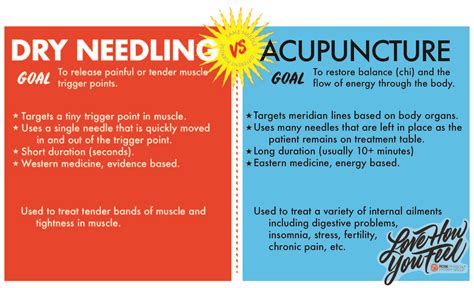 Basics of Trigger Point Dry Needling | Rose Physical Therapy Group