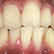 Dental Care Services – HCL-Healthcare