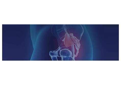 Sacral Nerve Stimulation