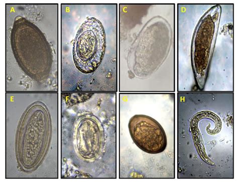 Intestinal Helminths in Wild Rodents from Native Forest and Exotic Pine ...