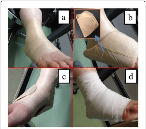 Image result for Lrather Fixation