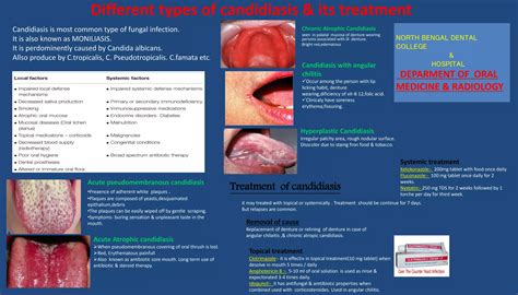Oral Candidiasis (Poster) | PPTX