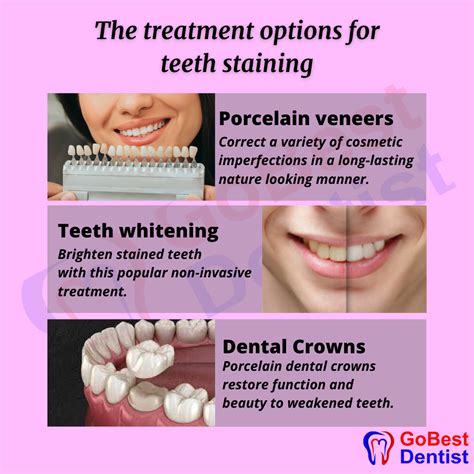 Tooth Discoloration Causes And Treatments