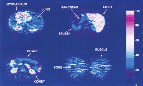 Tissue Distribution 的图像结果