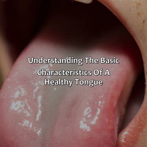 What Is A Healthy Tongue Color at Lilly Manning blog