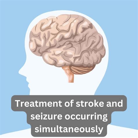 Stroke and Seizure: What to Expect? From Diagnosis to Treatment ...