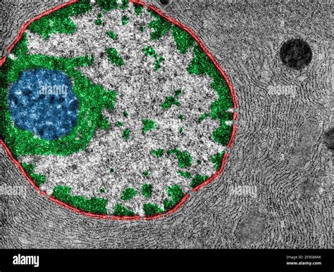 Nucleolus Micrograph