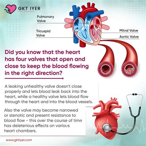 Hole In Heart Doesn't Close at Joseph Eason blog