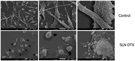 In Vitro Evaluation of NLS-DTX Activity in Triple-Negative Breast Cancer