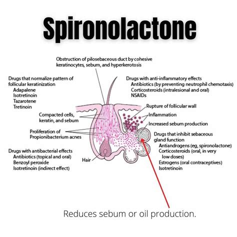 How Is Spironolactone Hazardous at Lois Toussaint blog