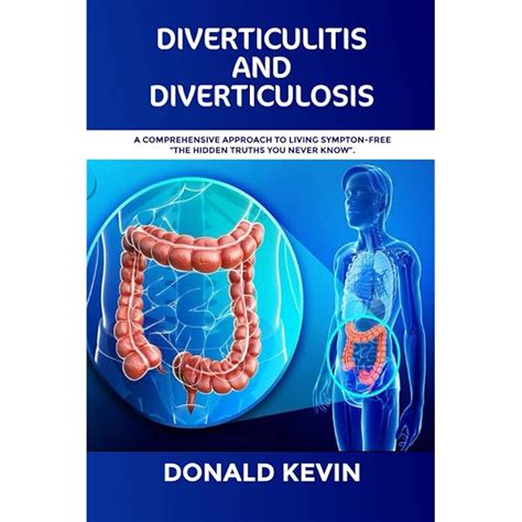 Buy Diverticulitis and Diverticulosis: A comprehensive approach to ...