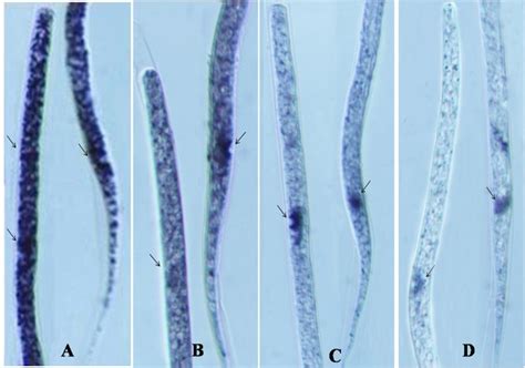 The effect of DEC, NTZ and NTZ+AgNPs on the TCA cycle enzymes of the ...