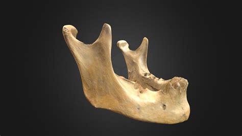 Anatomía De La Mandíbula Y El Maxilar Bruxismo Y Osteopatía Ramon