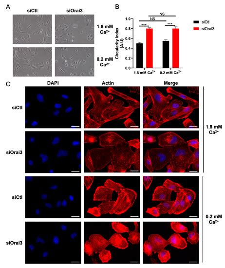 Orai3 Calcium Channel Regulates Breast Cancer Cell Migration through ...