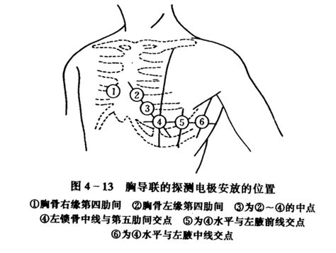 简易心电图教程（一）：如何看正常心电图 - 好医术早读文章 - 好医术-赋能医生守护生命