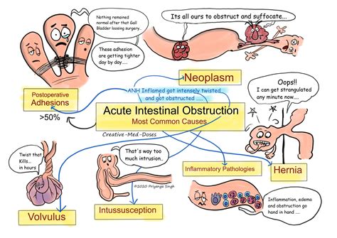 Acute intestinal obstruction: Pathophysiology - Creative Med Doses
