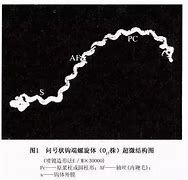 Image result for 螺旋体病