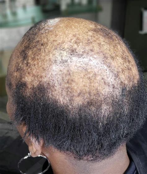 Trusttheprocess Hair Growth Oil UNISEX Product All Natural - Etsy