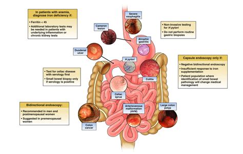 Iron deficiency anemia - AGA GI Patient Center