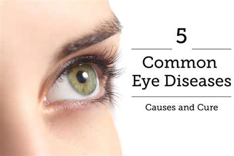 Image result for Common Eye Problems