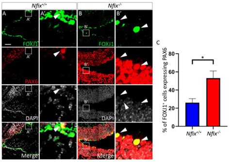 Hydrocephalus in Nfix−/− Mice Is Underpinned by Changes in Ependymal ...