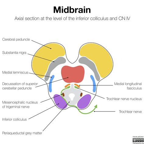Radiopaedia - Drawing Midbrain at level of inferior colliculus and ...