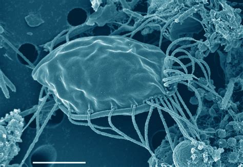 Newly-Discovered Protists Add New Branch to Tree of Eukaryotic Life ...
