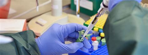 COVID-19 in India: Less than half the tests are RT-PCR