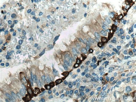 Cytokeratin 5 antibody (28506-1-AP) | Proteintech