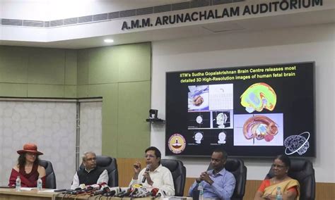 IIT Madras Releases World's First 3D Fetal Brain Atlas