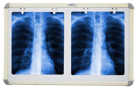 MEDIGUARD Premium Xray View Box, Double Film LED X-Ray View Box with ...