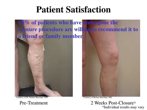 Image result for Closure Procedure